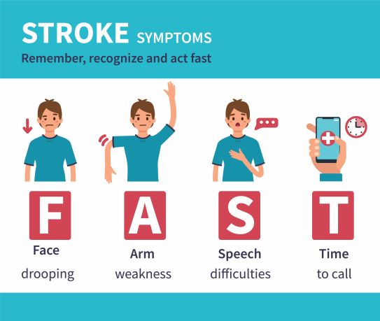 A cartoon picture of a man demonstrating the four main symptoms of a stroke. Face drooping, arm weakness, speech difficulties, time to call.