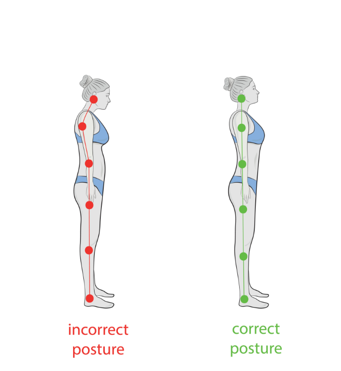 A drawing of a women demonstrating incorrect posture while standing vs. correct posture while standing.