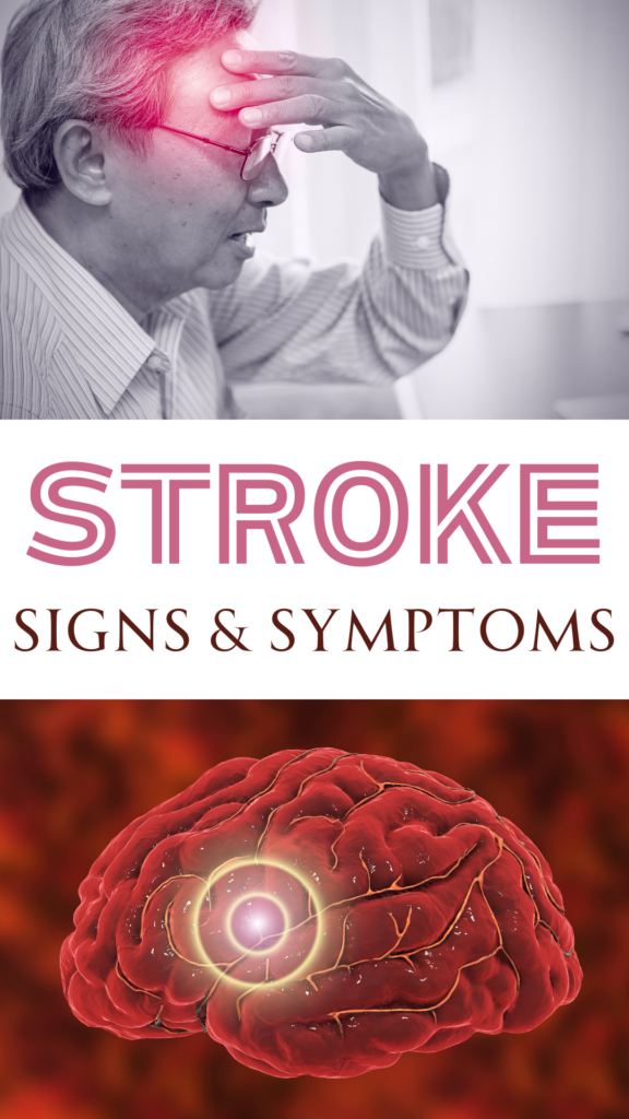 What You Need to Know About a Stroke and Rehabilitation After a Stroke